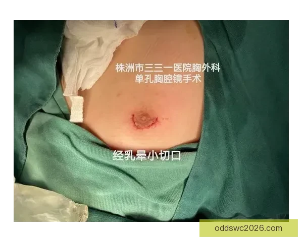 坎宁安气胸康复持续推进 活塞计划一周后复查评估 坎宁安气胸康复持续推进 活塞计划一周后复查评估